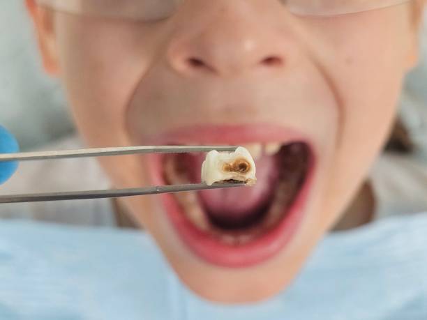 Best Urgent Dental Care for Toothache in Havelock, NC