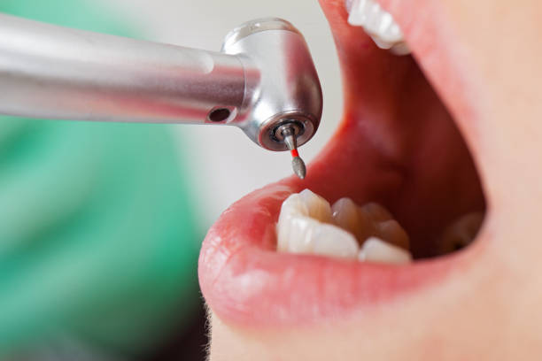 Best Pediatric Emergency Dentist in Havelock, NC